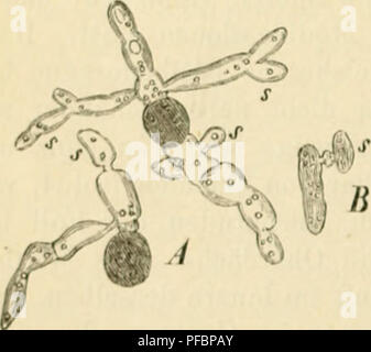 . Der Standpunkt der gegenwrtige Mycologie mit Rcksicht auf die Lehre von den Infections-Krankheiten. Pathogene Pilze. Abb. Ist.. Bitte beachten Sie, dass diese Bilder sind von der gescannten Seite Bilder, die digital für die Lesbarkeit verbessert haben mögen - Färbung und Aussehen dieser Abbildungen können nicht perfekt dem Original ähneln. extrahiert. Eidam, Michael Emil Eduard, 1845 -. Berlin, Oliven Stockfoto
