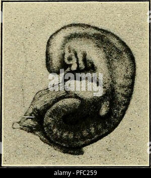 "Eine Studie über die Ursachen der Ursprung des menschlichen Monster: dritter Beitrag zur Untersuchung der Pathologie des menschlichen Embryos" (1908) Stockfoto