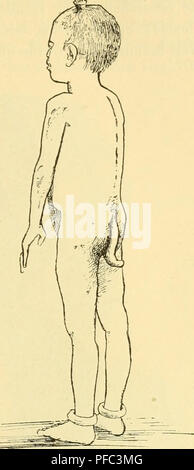 Diese Arbeit mit dem Titel „der Mensch, sein Ursprung und seine Entwicklung“ liefert eine vereinfachte Darstellung der menschlichen Evolution, einschließlich einer Diskussion über die embryonale Entwicklung des Menschen, wie das Vorhandensein von Lanugo-Haaren im sechsten Schwangerschaftsmonat. Es handelt sich um eine detaillierte, aber zugängliche Präsentation über den menschlichen Ursprung und die evolutionäre Entwicklung. Stockfoto