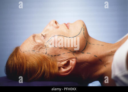Kopf und Hals einer reifen Frau auf dem Rücken liegend, die Augen öffnen, blaue Linien und gestrichelte Linien entlang der Wangen, von Tempel zu Hals, Seitenansicht Stockfoto