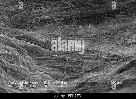 Ultrastrukturforschung Details auf der Oberfläche eines nicht identifizierten Wespen Nest in Decatur, Georgia, in der 158 ergab x vergrößert Rasterelektronenmikroskopische (SEM) Bild, 2006. Mit freundlicher Seuchenkontrollzentren (CDC). () Stockfoto