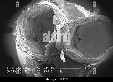 Ultrastrukturforschung Details auf der Oberfläche eines nicht identifizierten Wespen Nest in Decatur, Georgia, in den 12 x vergrößert Rasterelektronenmikroskopische (SEM) Bild 2006 ergab. Mit freundlicher Seuchenkontrollzentren (CDC). () Stockfoto