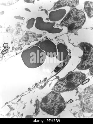 Gehirn Kapillare einer Maus experimentell infizierten intravenös mit Orientia tsutsugamushi rickettsial Mikroorganismen, im Getriebe Elektronenmikroskopischen (TEM) Bild, 1978 aufgedeckt. Mit freundlicher Seuchenkontrollzentren (CDC)/Dr Ed Ewing. () Stockfoto