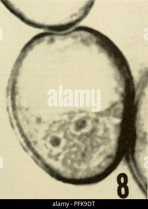 . Zytologie. Zytologie. Die ganze Zelle Volumen (Abbildung 3-33). Die kontraktilen Vakuolen der unteren Formen erscheinen ein Absondernden Funktion zu dienen, während die Großen der Durchführung von Geweben der Pflanzen notwendige Turgor für Sup-port zur Verfügung stellen kann. Die meisten Beweise würde vorschlagen, dass Vakuolen einfach einen Anzug - in der Lage Substrat für metabolische Reaktionen. In jedem Fall scheinen Sie von Universal auftreten sowohl in pflanzlichen und tierischen Zellen zu sein. Abbildung 3-33. Photomicrograph Große Vakuole in Microspore Zelle der Tradescantia paludosa. Hinweis exzentrische Position der Vakuole und Kern-, das zwei nukleolen. (Fr Stockfoto