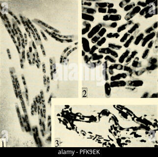 . Die cytologie und Leben - Geschichte der Bakterien. Bakterien. 158 DER ZYTOLOGIE UND LEBEN - Geschichte der Vor kurzem Lederberg und seine Mitarbeiter haben den Beweis, dass vegetative diploiden Belastungen von bact. coli bestehen können. Die Zellen sind länger als die haploids und haben eine größere Anzahl ähnlicher nuklearen Elementen. Ich %f ^. ^- •* - * a: cs^"^^. Bitte beachten Sie, dass diese Bilder sind von der gescannten Seite Bilder, die digital für die Lesbarkeit verbessert haben mögen - Färbung und Aussehen dieser Abbildungen können nicht perfekt dem Original ähneln. extrahiert. Bisset, Kenneth Alexander. Baltimore: W Stockfoto