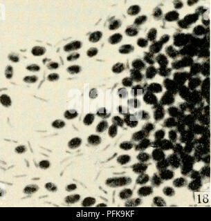 . Die cytologie und Leben - Geschichte der Bakterien. Bakterien. Ich^' • t "f passen. - Ein % tl7f rt19{Fhot" "utrosr "Pni hy Dr. E. Klu - nfbergfr - Sohfl. Aus dem Jourmil o] Allgemeine Mikrobiologie wiedergegeben). Abb. 47. Bitte beachten Sie, dass diese Bilder sind von der gescannten Seite Bilder, die digital für die Lesbarkeit verbessert haben mögen - Färbung und Aussehen dieser Abbildungen können nicht perfekt dem Original ähneln. extrahiert. Bisset, Kenneth Alexander. Baltimore: Williams und Wilkens Stockfoto