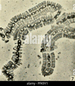 . Die cytologie und Leben - Geschichte der Bakterien. Bakterien. Ich aus dem Journal ofGemral M urohâ reproduziert, ^v, Hy/., Abb., 6., âf F, ul, -, sâr I. lomrsik). Bitte beachten Sie, dass diese Bilder sind von der gescannten Seite Bilder, die digital für die Lesbarkeit verbessert haben mögen - Färbung und Aussehen dieser Abbildungen können nicht perfekt dem Original ähneln. extrahiert. Bisset, Kenneth Alexander. Baltimore: Williams und Wilkens Stockfoto