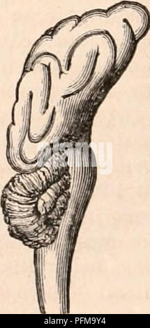 . Die cyclopaedia von Anatomie und Physiologie. Anatomie, Physiologie, Zoologie. der Entwicklung als besteht entweder in der cetacea, in keiner der Formen des herbivora oder in der marsupiata; die Hemisphären haben hier einen gut gekennzeichneten Überlegenheit der entwickeln- ment über das Kleinhirn und tubercula Quadri-gemina. Auf der anderen Seite das Gehirn des Carnivora ist weniger vorher als in der quadrumana, den vorderen Lappen, einige - was verengt und niedergedrückt, und der Con-volutions, (obwohl tiefer als in der Bestellung gerade erwähnt,) anstelle der labyrinthischen duplicatures die observabl entwickelt Stockfoto