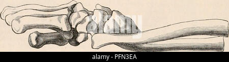 . Die cyclopaedia von Anatomie und Physiologie. Anatomie, Physiologie, Zoologie. 1520 HANDGELENK - GEMEINSAME (ABNORMALEN ANATOMIE^). extended als zuvor; der Schmerz verschwindet, und in etwa einen Monat nach der Fraktur aufgetreten ist, wenn eine vernünftige Behandlung angenommen werden, um die Union der Fragmente ist so perfekt, dass die passive Bewegung der Gelenke ihre primitiven Geschmeidigkeit wieder begonnen werden kann. Ungeachtet der Meinungen der Dupiiytren, Diday, &Amp;, &Amp; C., denken wir, dass sie in der Regel, im Fall von Koliken' Fraktur die Prognose günstig ist. Es kann nicht anders sein, wenn die styloid Prozess o Stockfoto