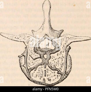 . Die cyclopaedia von Anatomie und Physiologie. Anatomie, Physiologie, Zoologie. Spinale nasennebenhöhlen vor gesehen. (Nach Breschet.) Der vordere Teil der Basis cranii und das Gesicht entfernt wurden, als auch die Einrichtungen der Wirbel. /, Seitliche sinus Absteigend der Kreuzung • Mit der Vena jugularis zu bilden; c, höhlenartigen Sinus; v, ver-tebral Arterie, die längs Kurven mit ihren quer Adern verbinden, liegen sofort sein - die Einrichtungen der Wirbel hind. Der Innenraum petrosal und die höhlenartige Nebenhöhlen erscheinen wie Con-tinuations davon in der Schädeldecke, und der Quer- und Ci Stockfoto