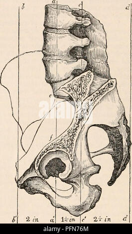 . Die cyclopaedia von Anatomie und Physiologie. Anatomie, Physiologie, Zoologie. Becken. sakrale Bogen, aber es widersteht ihre Vertreibung nach Innen, die vom Druck der femora in Richtung der Hälse dieser Knochen führen würde. Der Effekt dieser Druck, wenn die pnbes Ertrag, ist in der de-formity Die rostrated Becken bezeichnet wurde gezeigt, die sich aus der Niederschlagung dieser Knochen zusammen. Das Kinderbett 3'lo-pubic Arch empfängt auch in seiner Wölbung, Teil des Gewichts der Abdominal- Eingeweide, obwohl, aus dem Anhang dieser an der Wirbelsäule, deren chief Gewicht ist concentra Stockfoto