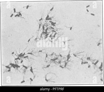 . Bakterien in Bezug auf die Fruchtbarkeit des Bodens. Boden Mikrobiologie, Bakteriologie, Landwirtschaftliche. 30 BAKTERIEN UND BODENFRUCHTBARKEIT Einige der krankheitserregenden Organismen sind m den Mund (manchmal in Personen anscheinend gesunden gefunden) und Sie können sicher die Reise von den Lippen eines auf die Lippen des anderen auf der gemeinsamen Trinkbecher. Die Finger sind immer Verbündeter den Weg nach dem Mund, und wenn der Speichel v ^ ere Indigo, was eine blaue Welt das wäre! Denn wir finden, dass "der Koch breitet seine Speichel auf die Muffins und Brötchen; die Kellnerin steckt die Gläser und Löffel, der angefeuchtet fi Stockfoto