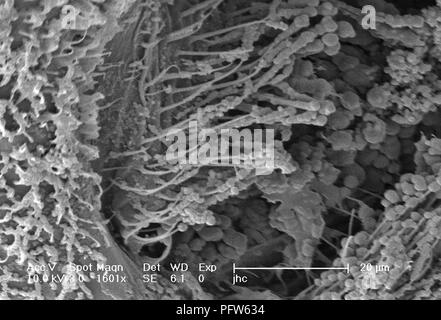 Morphologische Merkmale auf der Oberfläche eines exoskeletal Anopheles gambiae Mücke, in der 1601 x offenbart vergrößerte Rasterelektronenmikroskopische (SEM) Bild, 2006. Mit freundlicher Seuchenkontrollzentren (CDC)/Dr Paul Howell. () Stockfoto