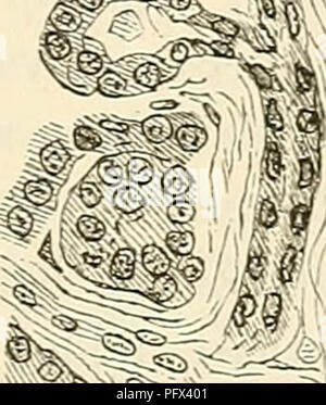 . Cursus der normalen Histologie zur Einführing in den Gebrauch des Mikroskopes, sowie in das practicche Studium der Gewebelehre. Die histologie; Mikroskopie. Ä^^^.tk^ ein. Abb. TU. Speicheldrüsen. A. Submaxillaris vom Katzen; Sclinittpräparat, gefärbt: a. Alveolen mit Schleimzelleu, eine "eine solche mit Elweisszellen. Eine "solche mit Halbmonden; sp. Speichelnihren. Liebe Gr, eine schräg gewürfelt, g. Gefässe in einem grösseren Bindegewebsseplum. ^ "^w.li. Pankreas, Schnitt in Eosin-Methylenblau gefärbt; im oberen Theil der Figur des Drüsenalveolus Zusammenhang mit einem Ausführungsgang. sp Stockfoto
