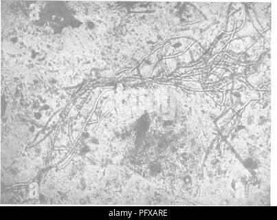 . Bakteriologie und Mykologie von Lebensmitteln. Essen. Abb. 1. - Normale Tomatenketchup, Zellen und granulare Inhalt (X200). Abb. 2.-Mold-Filament aus Ketchup 'Rom Teilweise verfiel Lager (X150). Auf Seite 516.. Bitte beachten Sie, dass diese Bilder sind von der gescannten Seite Bilder, die digital für die Lesbarkeit verbessert haben mögen - Färbung und Aussehen dieser Abbildungen können nicht perfekt dem Original ähneln. extrahiert. Tanner, Fred Wilbur, 1888-1957. New York, John Wiley & Amp; Söhne, Inc.; [etc. , Etc. ] Stockfoto