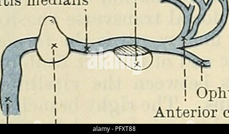 . Cunninghams Lehrbuch der Anatomie. Anatomie. 1038 Die VASCULAE SYSTEM. Letzteres wird der linken Vena advehens, weiterhin bis zur Geburt und, nach dem Verschwinden des Ri°ht seitliche Vena umbilicalis, es vermittelt das Blut aus der Plazenta in die Leber, wo ein Teil der Plazenta Blut strömt in die linke Vena advehens und so durch die linke Vena revehens in die Vena cava inferior, und ein Teil geht in den Ductus venosus, durch die es erreicht, die auf den Teil des Cephalen Teil der rechten Vena advehens, die in die Vena cephalica oder oberen Ende der permanenten Vena cava inferior. Nach der Geburt Stockfoto