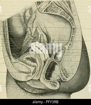 . Cunninghams Lehrbuch der Anatomie. Anatomie. Die weibliche UBETHEA. 1285 Struktur. - Die Mauer der weibliche Harnröhre ist dick und enthält viel fibrösem Gewebe, die vergeht, ohne scharfe Linie der Demarkation in die umgebende Masse des Bindegewebes. Die Tunica muscularis oder muskulösen Mantel der Harnröhre ist kontinuierliche oben mit, dass der Blase, und ist aus Schichten von zirkular und longitudi-Intern entsorgt glatte Muskelfasern angeordnet, die äußeren und inneren Schichten zu bilden. Innerhalb der muskulösen Mantel die Wand der Harnröhre ist sehr Gefäßdiagnostik und den Kanal selbst wird von einem blassen Schleimhäuten ausgekleidet Stockfoto