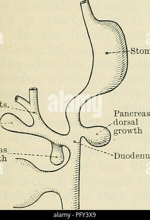 . Cunninghams Lehrbuch der Anatomie. Anatomie. jDiaphragm Milz überquert mesogastrium Bauchspeicheldrüse Superior mesen - teric Arterie Duodenum Colon minderwertig Mesen - teric Arterie des Mesenteriums Aorta Abb. 977.-- zwei Diagramme zur Entwicklung des Darmkanals illustrieren. Die Abbildung rechts zeigt die Drehung des intestinalen Schleife um die A. mesenterica superior. In beiden Abbildungen sind die Teile von der linken Seite angesehen zu werden. Die Galle-Kanäle innerhalb der Leber dar. Neben trabeculse angeordnet in der Form eines lobule geworden, jeder mit einer vaskulären Kanal in seinem Inneren Stockfoto