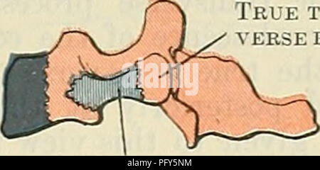 Cunninghams Text-Book of Anatomy ist eine umfassende Ressource, die sich auf die menschliche Anatomie konzentriert und Aspekte wie die Zervixregion, transversale Prozesse und die neurozentrale Naht abdeckt. Es dient als wichtige Referenz für Anatomiestudenten und Fachleute. Stockfoto