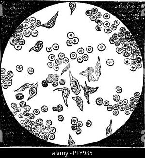 . Chemische und physikalische Analyse von Milch, Kondensmilch, und Kleinkinder Milch - Lebensmittel, besonders im Hinblick auf die Hygiene und sanitären Milch Inspektion: ein Labor Guide, der auf Erfahrungen aus der Praxis entwickelt, Einzelkomponenten, die für Chemiker, Mediziner, sanitarians, Studenten, etc. Milch; Säuglinge und Kleinkinder. JPms; Eiter Blutkörperchen in der Milch als blasse kugelförmigen Körpern unterschiedlicher Größe angezeigt. Sie verfügen über eine leicht körnige Oberfläche, die auf die Zugabe von Essigsäure verschwindet, während die Blutkörperchen wesentlich vergrößert. Eiter Blutkörperchen und Epithelzellen. EpWielial Zellen in der Milch gefunden aber nur selten, und dann, per-haps Stockfoto