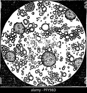 . Chemische und physikalische Analyse von Milch, Kondensmilch, und Kleinkinder Milch - Lebensmittel, besonders im Hinblick auf die Hygiene und sanitären Milch Inspektion: ein Labor Guide, der auf Erfahrungen aus der Praxis entwickelt, Einzelkomponenten, die für Chemiker, Mediziner, sanitarians, Studenten, etc. Milch; Säuglinge und Kleinkinder. 16. JPms; Eiter Blutkörperchen in der Milch als blasse kugelförmigen Körpern unterschiedlicher Größe angezeigt. Sie verfügen über eine leicht körnige Oberfläche, die auf die Zugabe von Essigsäure verschwindet, während die Blutkörperchen wesentlich vergrößert. Bitte beachten Sie, dass diese Bilder aus gescannten Seite Bilder, die digital wurden extrahiert werden Stockfoto