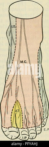 . Cunninghams Lehrbuch der Anatomie. Anatomie. SUPEEFICIAL PEEONEAL NEEVE. 731 2. Terminal Zweige (auf dem Fuß). - Das terminal Zweige medial und lateral. Die medial Branch führt entlang der Dorsum des Fußes auf der lateralen Seite der Direktbestellung Arterie zu den ersten interosseous Raum, wo es teilt sich in zwei Dorsalen digitale Niederlassungen für die Versorgung der Haut von der Seite der großen Zehe und der medialen Seite der zweiten Zehe (Nervi digitales dorsales hallucis lateralis et seiner antireflektiven secundi Medialis). Jeder dieser Niederlassungen kommuniziert mit Zweigen von der oberflächlichen Peronaeus Stockfoto