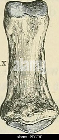 . Cunninghams Lehrbuch der Anatomie. Anatomie. Der PHALANGEN. 227. Phalanx, ungual oder Terminal II. Phalanx die Sicherheiten Bänder des metacarpophalangeal gemeinsame und auch der interossei Muskeln. Das distale Ende ist viel kleiner als der proximalen; die konvexe Gelenkknorpel Oberfläche ist in zwei kondylen durch eine zentrale Nut läuft vor Rückwärts unterteilt. Die Phalanx Secunda (zweite Phalanx) ähnelt der Ersten in allgemeiner Form, ist aber von geringer Größe. Es unterscheidet sich jedoch in der Form der proximale Gelenk Oberfläche, die nicht einfach eine ovale Wölbung, aber ist eine ovale Fläche in t unterteilt Stockfoto