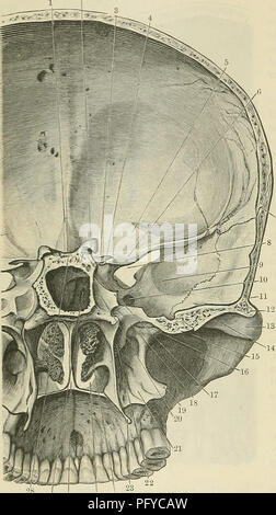 . Cunninghams Lehrbuch der Anatomie. Anatomie. 190 OSTEOLOGIE. Knochen und der Union mit den Oberkiefer. Gerade über diese die Eröffnung des pterygo - Pfälzer Kanal, der führt vom pterygopalatine Fossa, die unter der Oberfläche des harten Gaumens, ist sichtbar; während Inferiorly, einen kleinen Teil des unteren Teils des Lateralis fossa wird durch Schneiden. Innerhalb der choanse die mittlere und untere Concha? . Gesehen werden; die untere Grenze des ehemaligen entspricht der superior Grenze der Jochbeinbogen, während die angefügten Kante des letzteren an den senkrechten Teil der pa Stockfoto