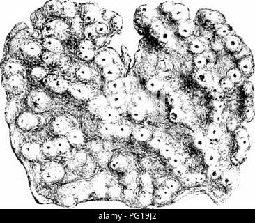 . Eine Monographie des Britischen Spongiadae. Schwämme. Platte XL.. Bitte beachten Sie, dass diese Bilder sind von der gescannten Seite Bilder, die digital für die Lesbarkeit verbessert haben mögen - Färbung und Aussehen dieser Abbildungen können nicht perfekt dem Original ähneln. extrahiert. Bowerbonk, James Scott, 1797-1877; Norman, Alfred Merle, 1831 - red. London Pub für den Ray Gesellschaft von R. Hardwicke Stockfoto