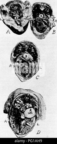 . Die Anatomie der Haushühner. Heimische Tiere; Veterinärmedizin; Geflügel. Ich 66 ANATOMIE DER HAUSHÜHNER. Abb. 48.- Querschnitte des Körpers eines Baby chick zu schlüpfen. R, rechte Seite. L, linke Seite. A. ein Querschnitt bei A, Abb. 50. Ich, Rückenmark. 2, Speiseröhre. 3, Eintritt in den Thorax. 4, Stubs der Flügel. B. eine transversale Abschnitt B, Abb. 50. Ich, Rückenmark. 2, Speiseröhre. 3, Lunge. 4, Herz. C. ein Querschnitt durch den Körper bei C, Abb. 50. Ich, Rückenmark. 2, Lunge. 3, Speiseröhre. 4, Leber. 5, Herz. D. einen Querschnitt bei D, Abb. 50. Ich, Rückenmark. 2, Prov Stockfoto