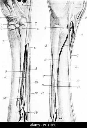Diese Platte veranschaulicht die chirurgische Anatomie der Mittelfußregion des Pferdes und hebt wichtige Strukturen wie Sehnen, Bänder, Knochen, Arterien und Nerven hervor. einschließlich der Cuneischen Sehne, Perforansehne und Arteria plantaris interna. Stockfoto