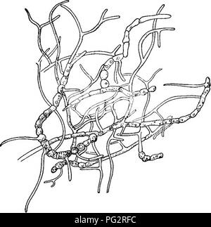Diese Arbeit beschäftigt sich mit der Verteilung von Pilzsporen in Haushalten, wobei der Schwerpunkt auf der Frage liegt, wie sich Fruchtverfall über Sporen ausbreiten kann, und der Rolle von Bakterien, Hefen und Schimmelpilzen bei Zerfallsprozessen. Stockfoto