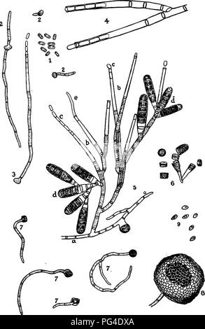 . Ein text-Buch der Mykologie und Pflanzenpathologie. Pflanzenkrankheiten; Pilze in der Landwirtschaft; Krankheiten; Pilze. 552 spezielle PFLANZENPATHOLOGIE. Abb. 197.-Root-rot Pilz (Thielavia basicola) in verschiedenen Stadien. (Nach Gilbert, W. W., Bull. 158, US Bureau von Anlagen der Industrie, 1909.). Bitte beachten Sie, dass diese Bilder sind von der gescannten Seite Bilder, die digital für die Lesbarkeit verbessert haben mögen - Färbung und Aussehen dieser Abbildungen können nicht perfekt dem Original ähneln. extrahiert. Harshberger, John W. (John William), 1869-1929. Philadelphia: s. Blakiston's Sohn &Amp; Co Stockfoto