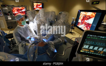 August 24, 2018 - Davenport, Iowa, USA - Timothy Paul Kresowik, MD von urologischen Teilnehmern Uhren die Chirurgie auf den Monitoren und unterstützt während des Verfahrens durch das Auswechseln der Werkzeuge auf die Roboterarme und das Absaugen von Flüssigkeiten aus dem Bauch während der Chirurgie. (Bild: © Kevin E. Schmidt/Viererkabel - Zeiten/Viererkabel - Zeiten über ZUMA Draht) Stockfoto