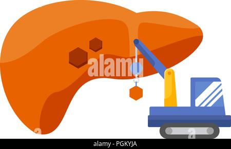 Leber Infografik Vector Illustration. Behandlung Regeneration decay Droge. Regeneration der Leber Stock Vektor