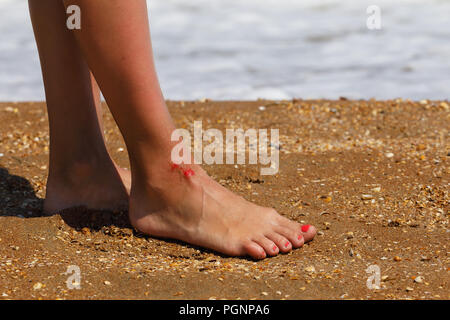 Wunde am Bein als Zeichen der nicht aufmerksam Verhalten am Strand Stockfoto