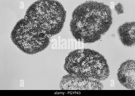 Gram-negative Bakterien Neisseria gonorrhoeae in einem Getriebe Elektronenmikroskopischen (TEM) Bild, 1980 aufgedeckt. Mit freundlicher Seuchenkontrollzentren (CDC)/Joe Miller. () Stockfoto