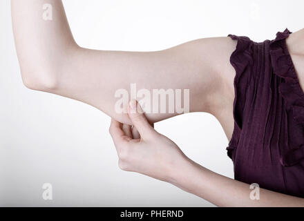 Womans Hand kneifen im oberen Arm Stockfoto