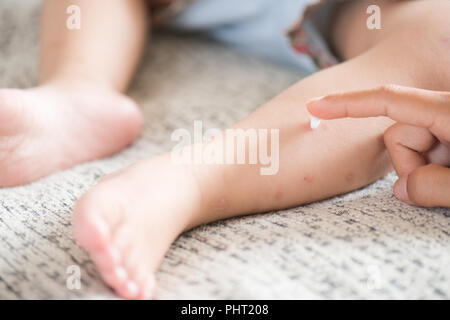 Mutter der Anwendung die Creme auf die Beine ist ein Mädchen mit roten Fleck, Blister. Medizin und Gesundheit Konzept. Stockfoto