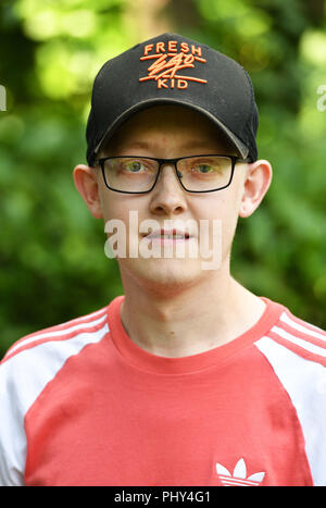 Auf 0001 Embargo Dienstag, 4. September Lukas Palfreyman, 23, aus South Yorkshire auf dem Gelände des Papworth Krankenhaus in Cambridgeshire, sechs Monate nach dem großen Transplantationschirurgie, vor der Organspende Woche. Stockfoto