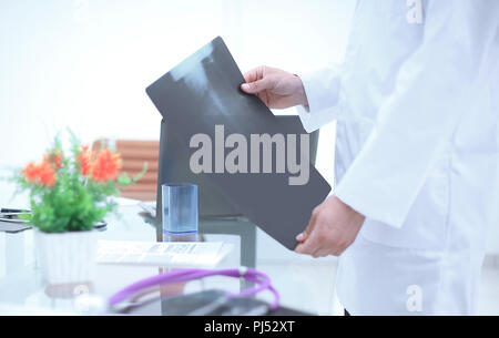 Bis zu schließen. x-ray Bild des Patienten in den Händen des Arztes Stockfoto
