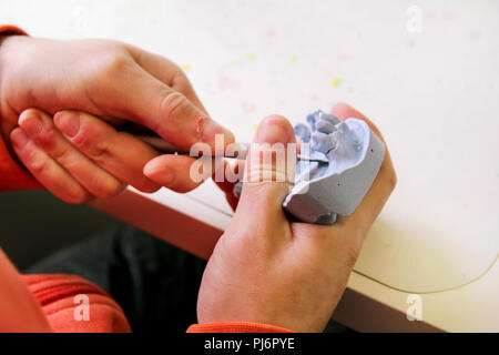 Arbeiten an er Gipsmodell der Kiefer. Zahnersatz. Zahnersatz, Prothesen, Prothetik arbeiten. Zahntechniker im Prozess der Herstellung von Zahnersatz. Stockfoto