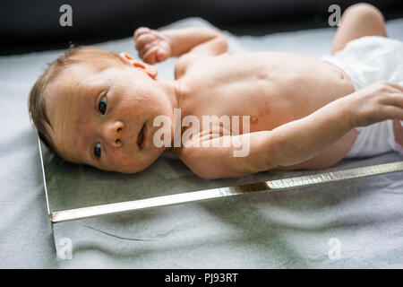 Neugeborenes Baby Boy mit vielen Pickeln, deren Wachstum gemessen wird. Stockfoto