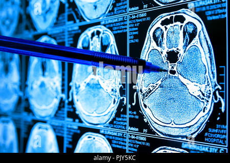 Künstliche Intelligenz in smart Healthcare Hospital Technologie Konzept. Arzt Kugelschreiber mit AI biomedizinische Algorithmus Bildschirm und Machine Learning uvek Stockfoto