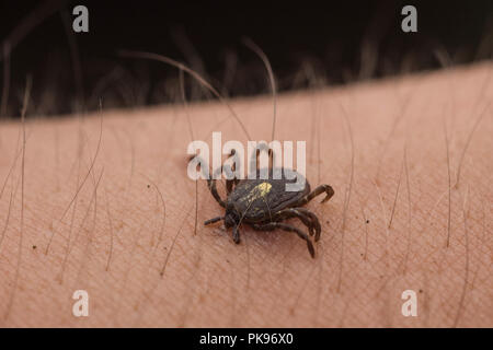 Ein eingebettetes tick aus Peru, Zecken sind als Überträger von Krankheiten, die die menschliche Gesundheit weltweit beeinflussen. Stockfoto