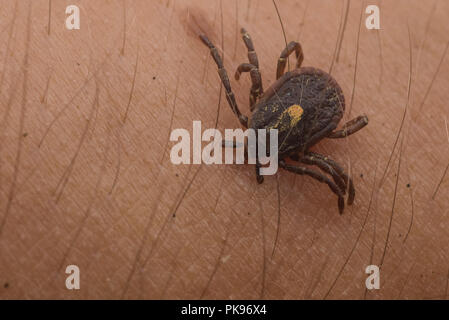 Ein eingebettetes tick aus Peru, Zecken sind als Überträger von Krankheiten, die die menschliche Gesundheit weltweit beeinflussen. Stockfoto