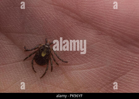 Ein eingebettetes tick aus Peru, Zecken sind als Überträger von Krankheiten, die die menschliche Gesundheit weltweit beeinflussen. Stockfoto