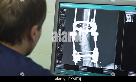 Tierärztin sieht sich der Monitor X-ray Image der Tatze des gebrochenen Hund mit ilizarov der Apparate. X-ray Image der Hund auf dem Monitor in einer Tierklinik. Stockfoto