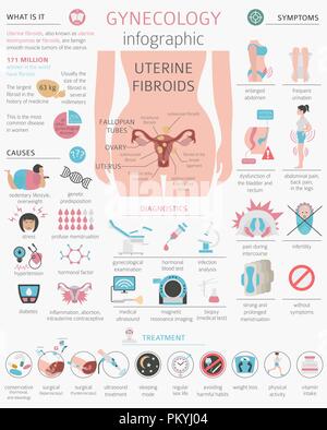 Uterusmyome. Ginecological medizinische Krankheit bei Frauen Infografik. Vector Illustration Stock Vektor