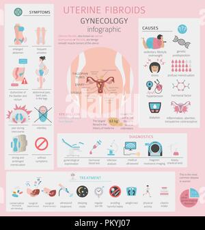 Uterusmyome. Ginecological medizinische Krankheit bei Frauen Infografik. Vector Illustration Stock Vektor